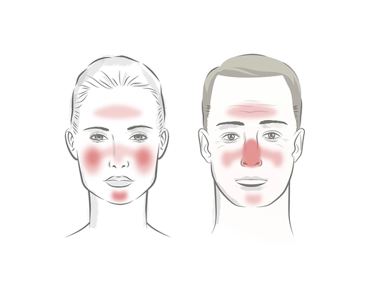 info-519-405 info-519-405